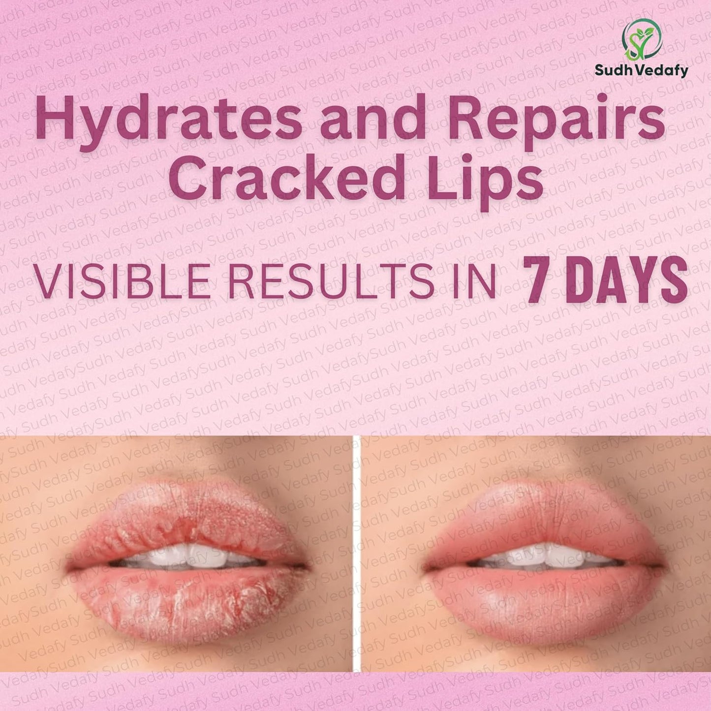 Sudh Vedafy Sri Ram Nabhi Tailam 30ml | Ayurvedic Multi Benefit Nabhi Oil | Belly Button oil for Skin & Hair | Nabhi Oil ayurvedic for Health and Beauty | नाभि तेल ( 30 Ml )